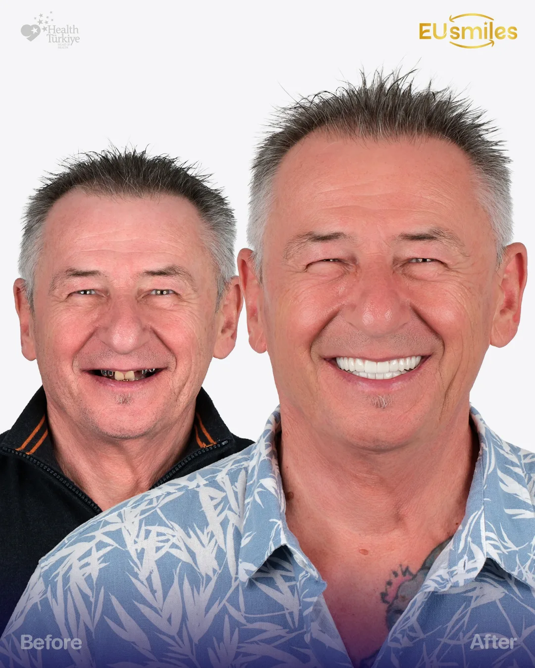 Ezsias A. — Dental Implants