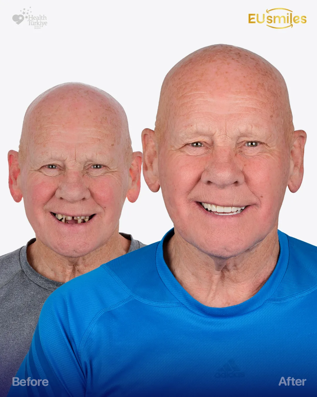 William K. — Hollywood Smile