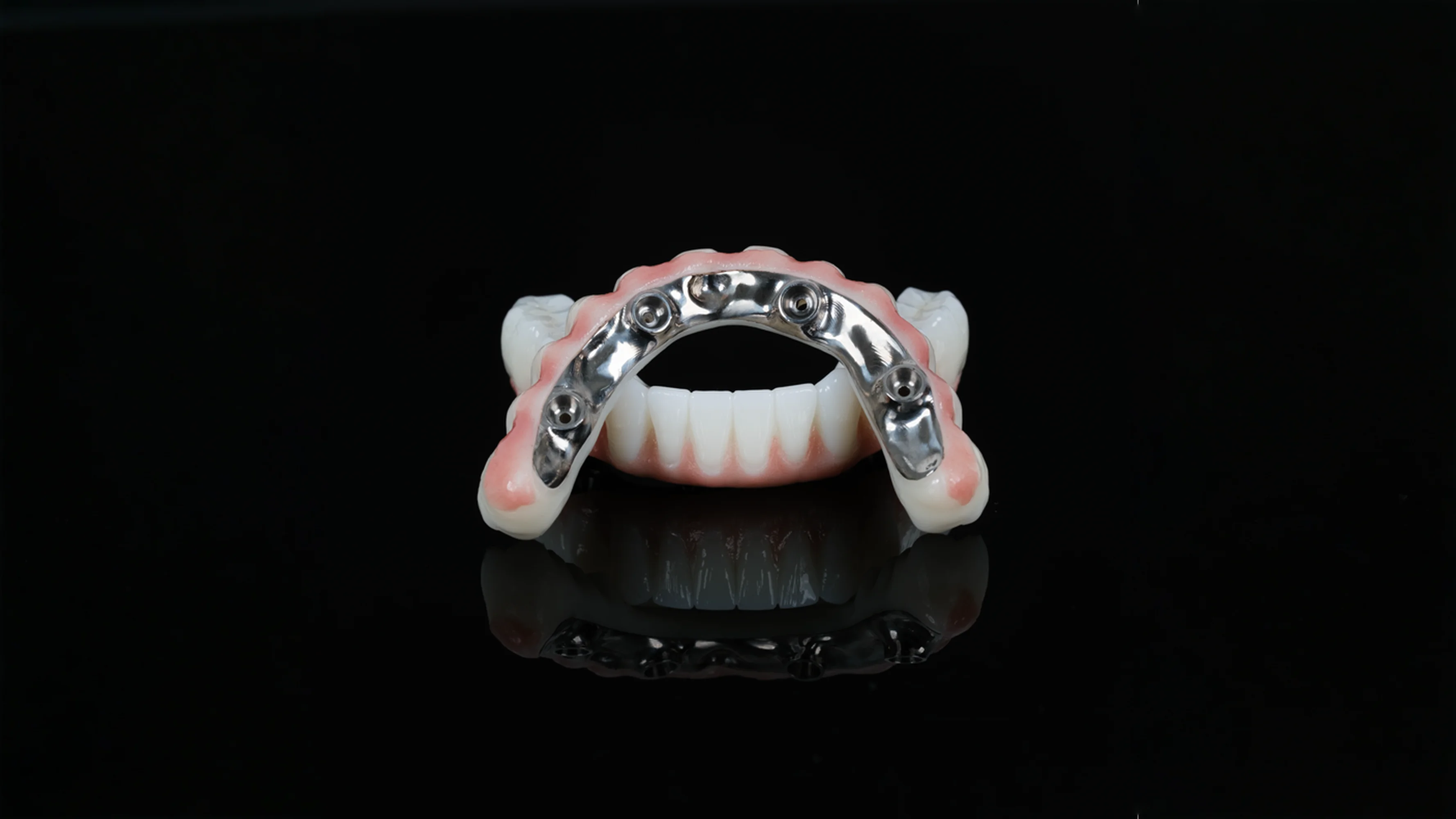 All-on-4 hambaimplantaadid Antalyas