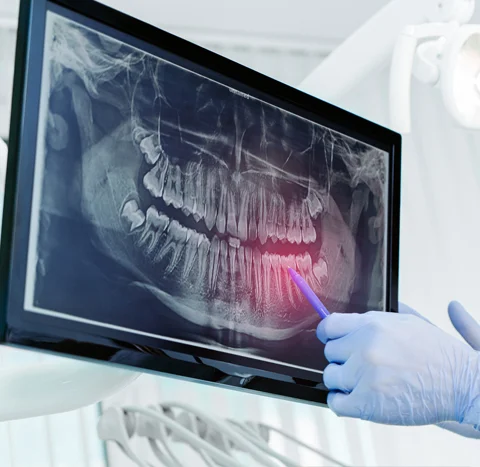 Digital X-rays and treatment planning