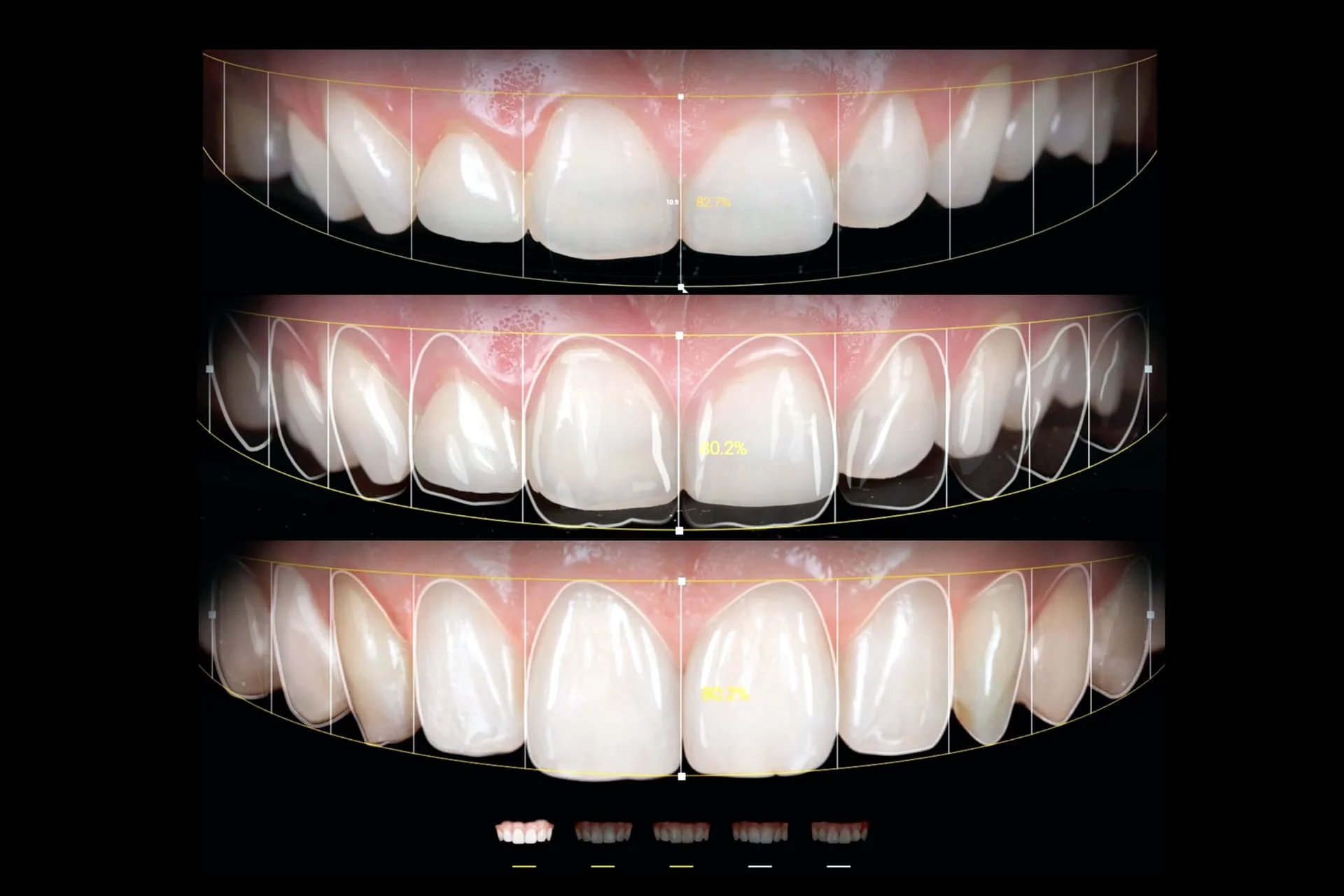 Digital Smile Design planning session at EUSmiles
