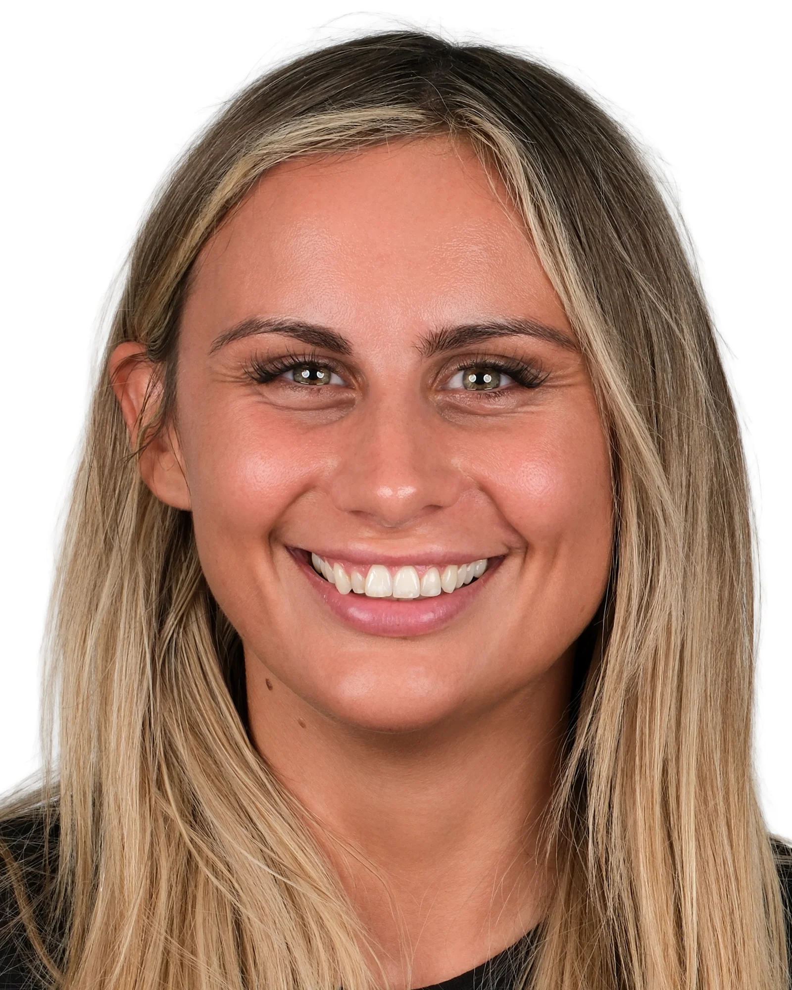 Smile Makeover Before