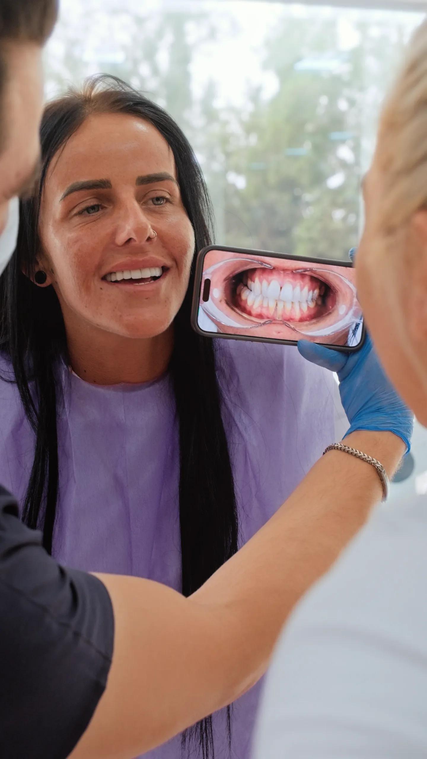 Smile Makeover