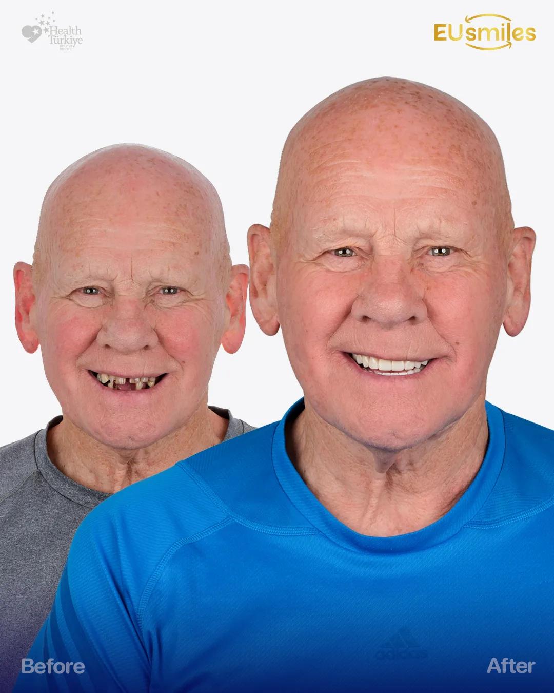 William K. — Hollywood Smile