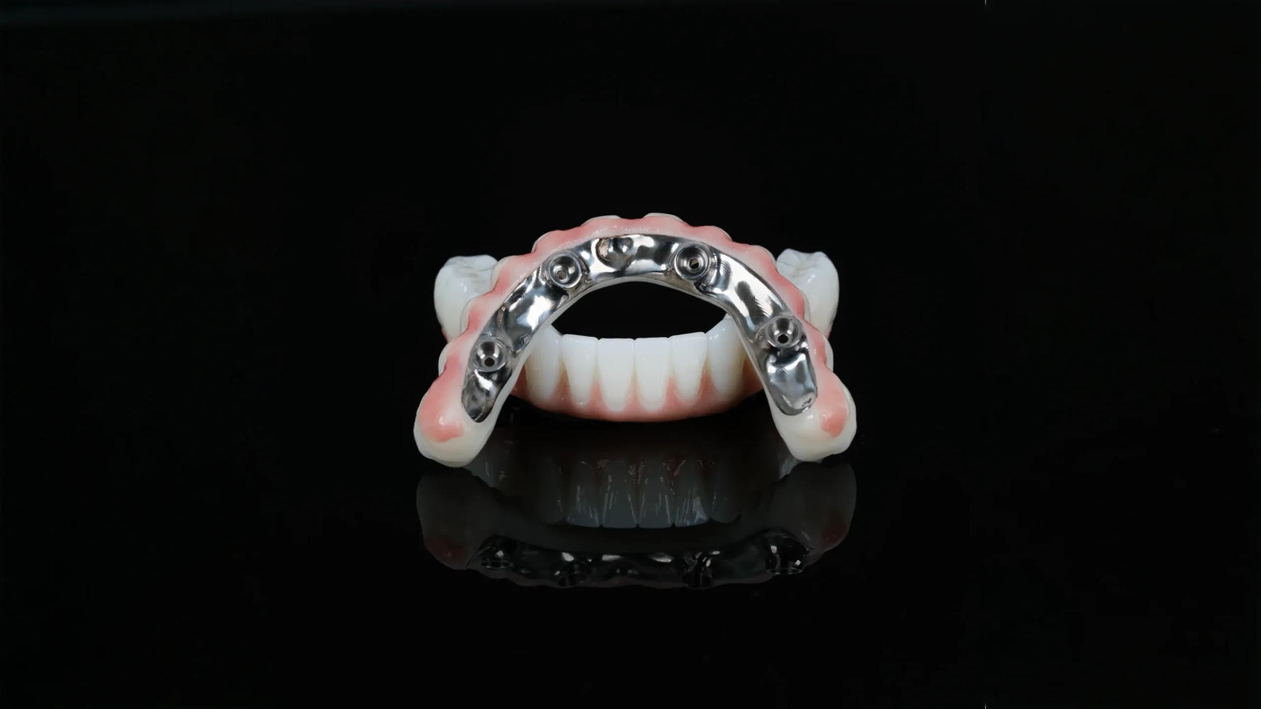 All-on-4 Implants