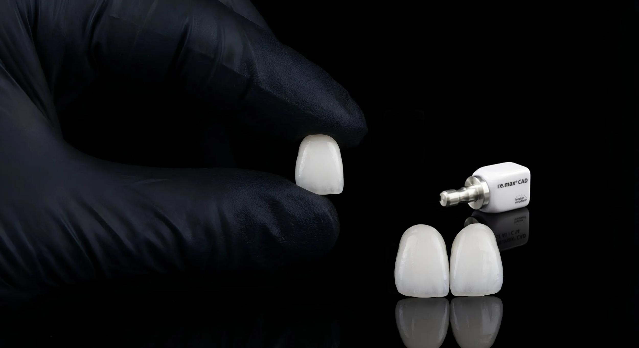 Dental Veneers