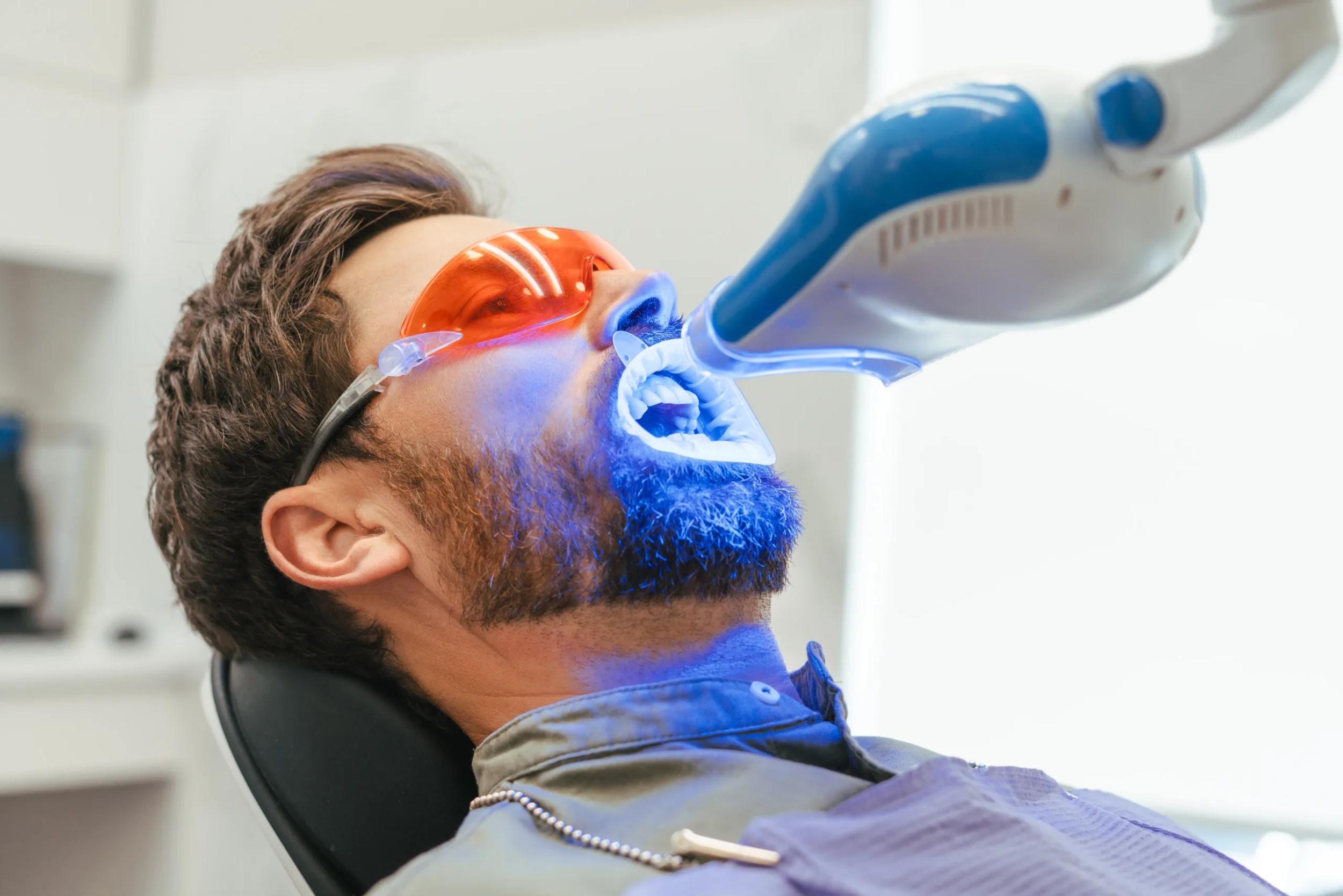 Teeth Whitening